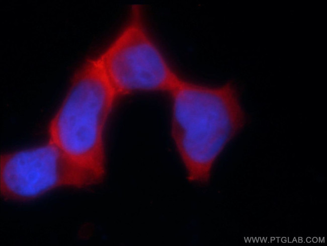 PSMC3 Antibody in Immunocytochemistry (ICC/IF)