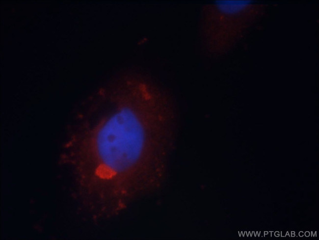 PSMC3 Antibody in Immunocytochemistry (ICC/IF)