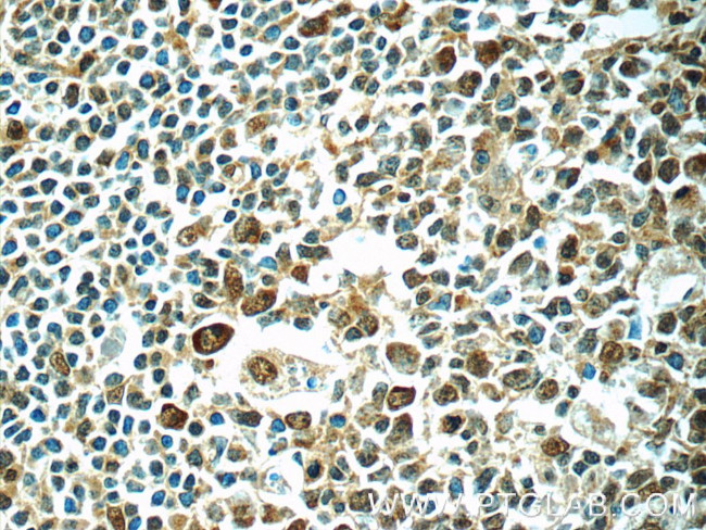 PSMC3 Antibody in Immunohistochemistry (Paraffin) (IHC (P))