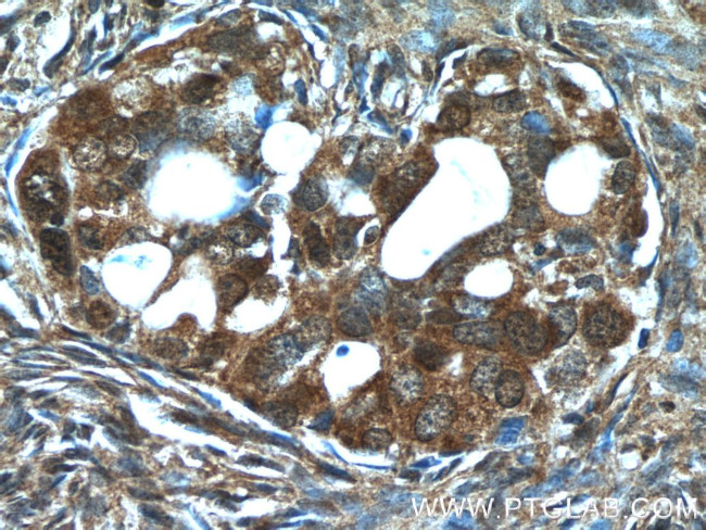 PSMC3 Antibody in Immunohistochemistry (Paraffin) (IHC (P))