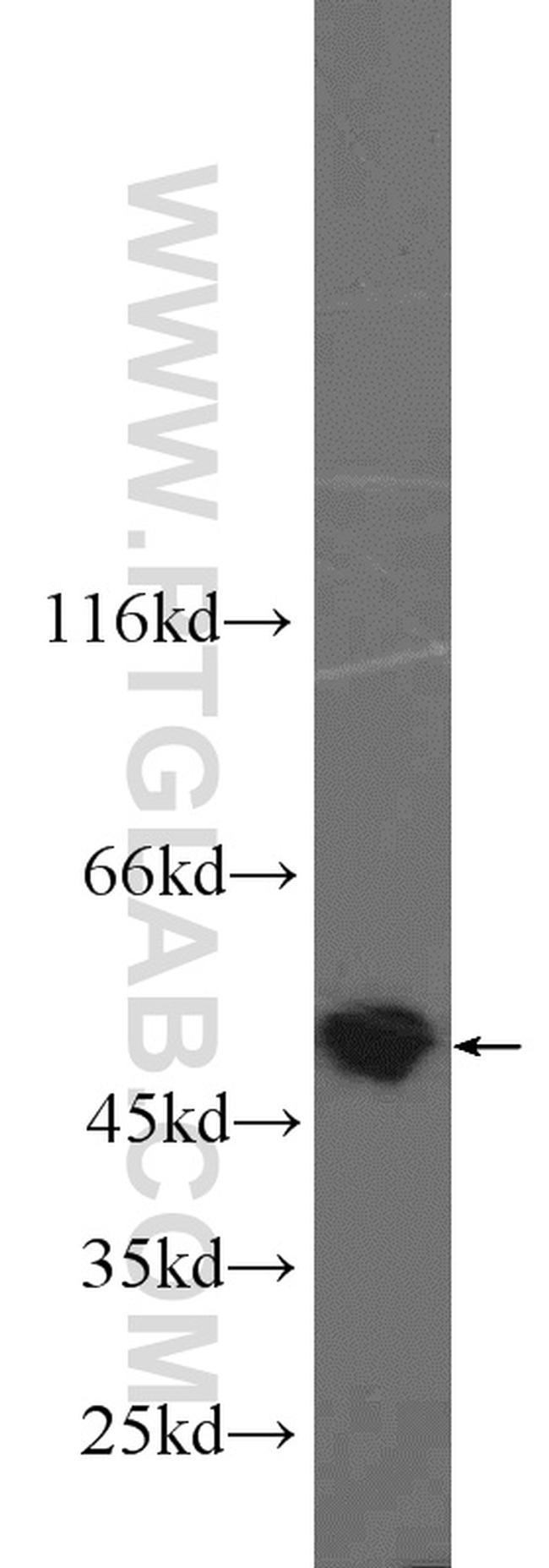 PSMC3 Antibody in Western Blot (WB)