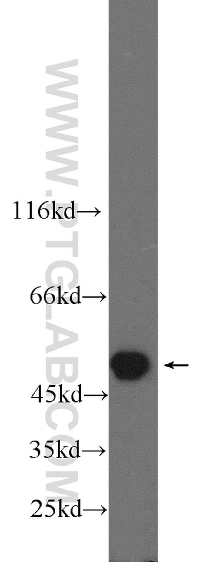 PSMC3 Antibody in Western Blot (WB)