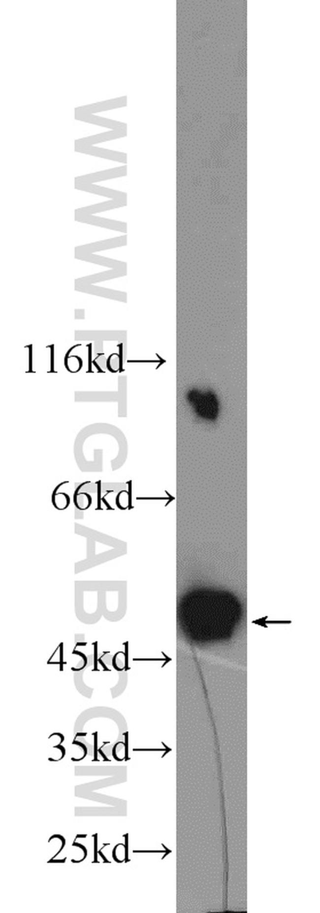 PSMC3 Antibody in Western Blot (WB)