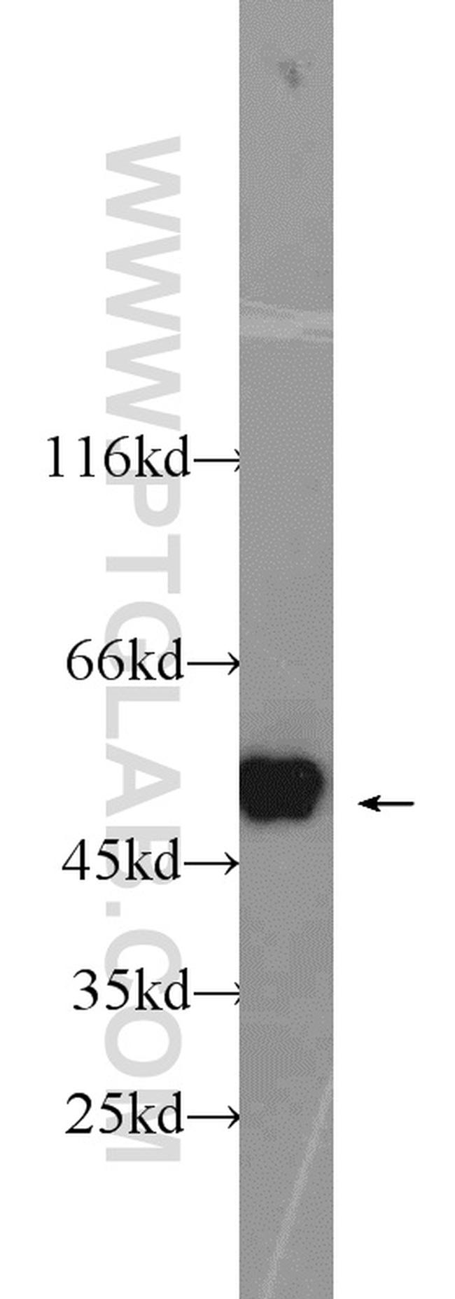 PSMC3 Antibody in Western Blot (WB)