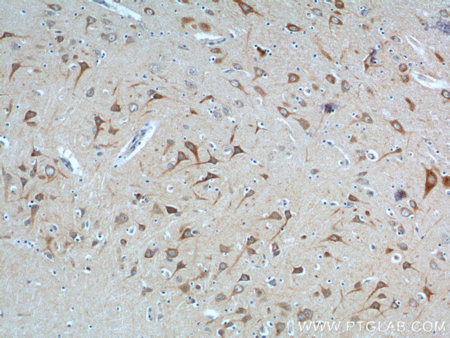 NPBWR2 Antibody in Immunohistochemistry (Paraffin) (IHC (P))