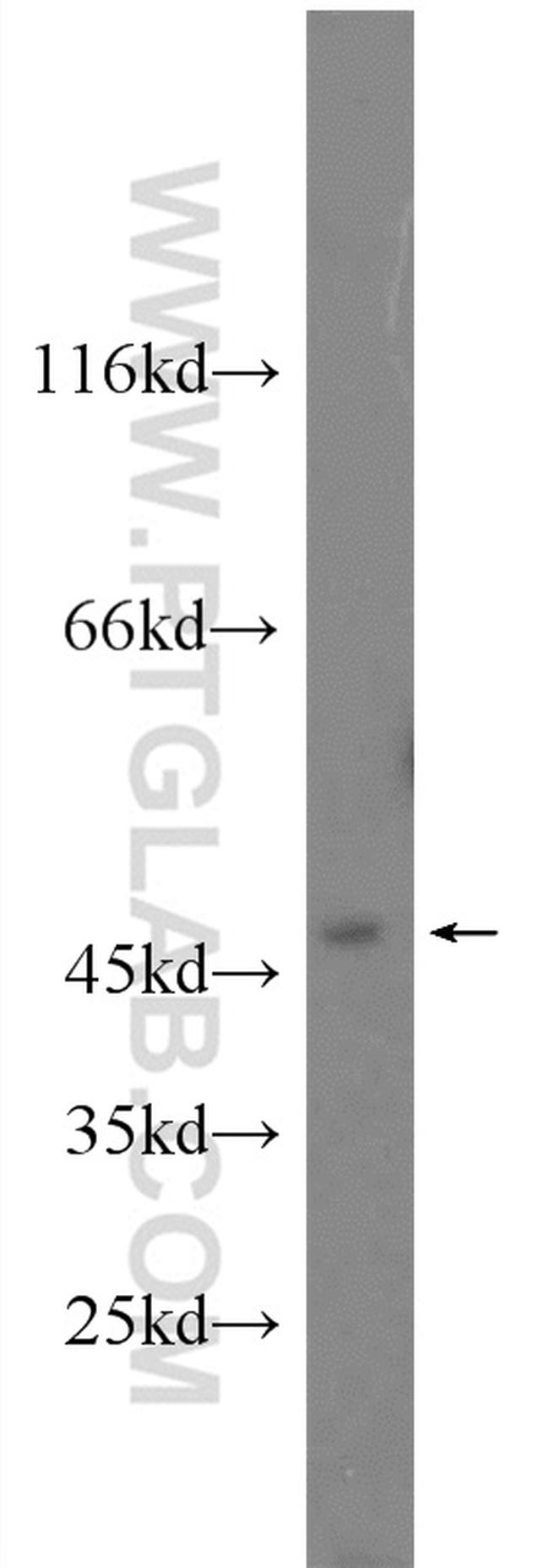 JNK Antibody in Western Blot (WB)