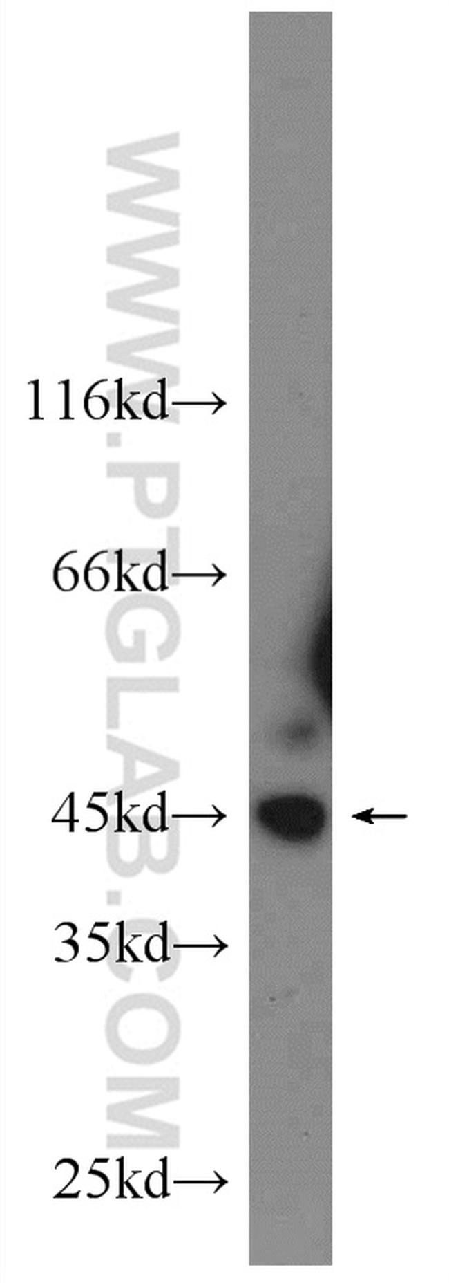 JNK Antibody in Western Blot (WB)