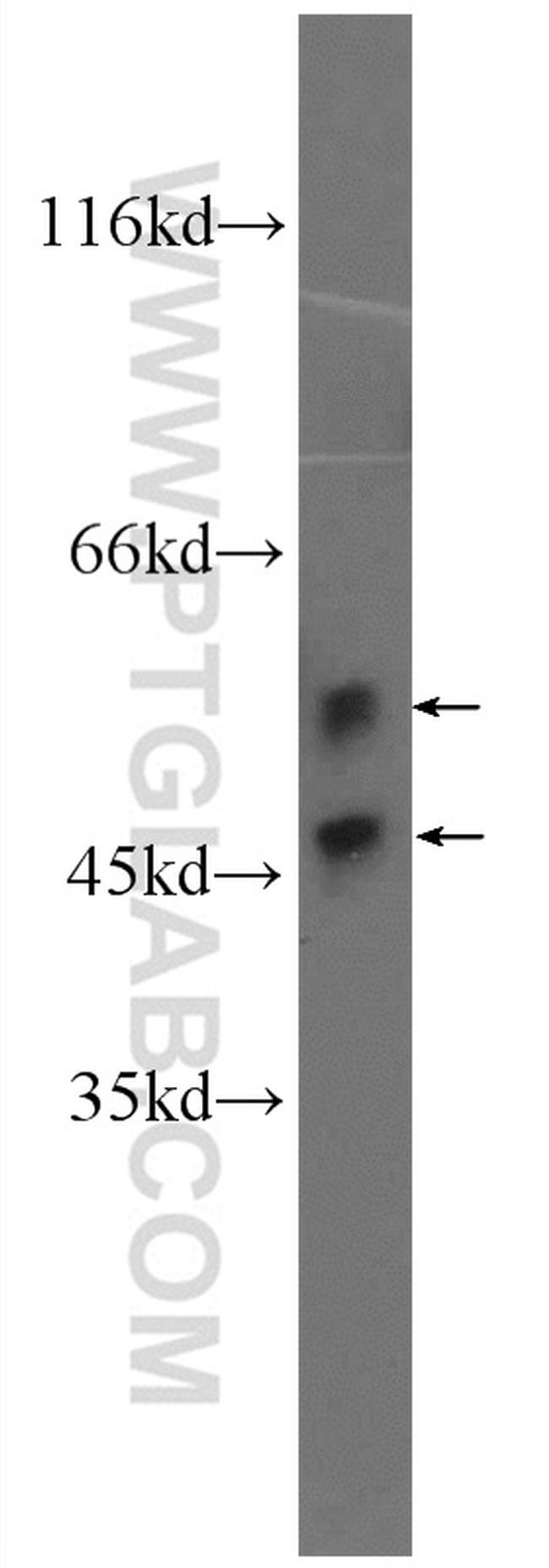 JNK Antibody in Western Blot (WB)