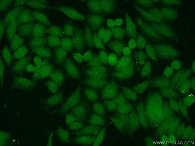 JNK Antibody in Immunocytochemistry (ICC/IF)