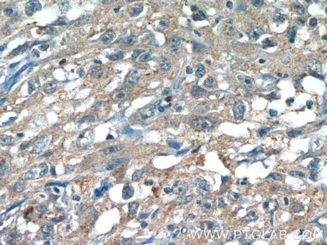 JNK Antibody in Immunohistochemistry (Paraffin) (IHC (P))