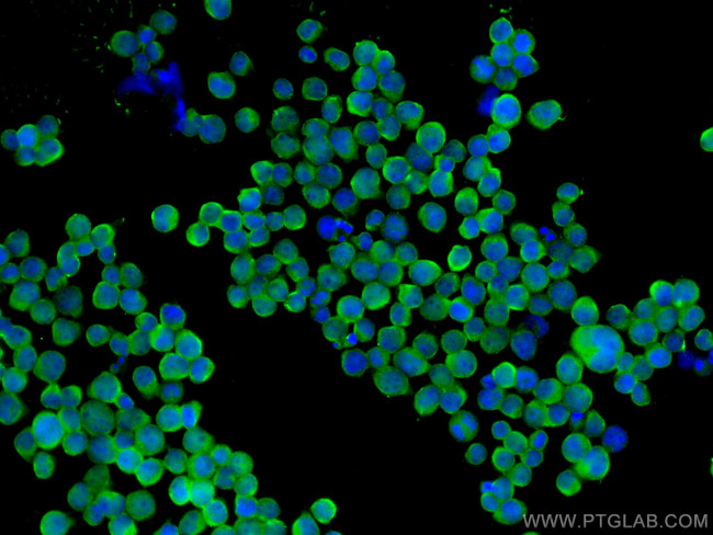 JNK Antibody in Immunocytochemistry (ICC/IF)