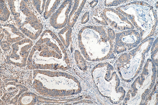 JNK Antibody in Immunohistochemistry (Paraffin) (IHC (P))