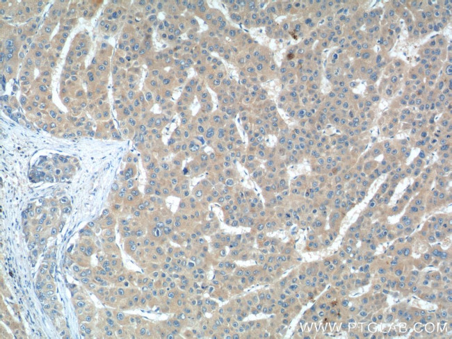 IL-27 Antibody in Immunohistochemistry (Paraffin) (IHC (P))