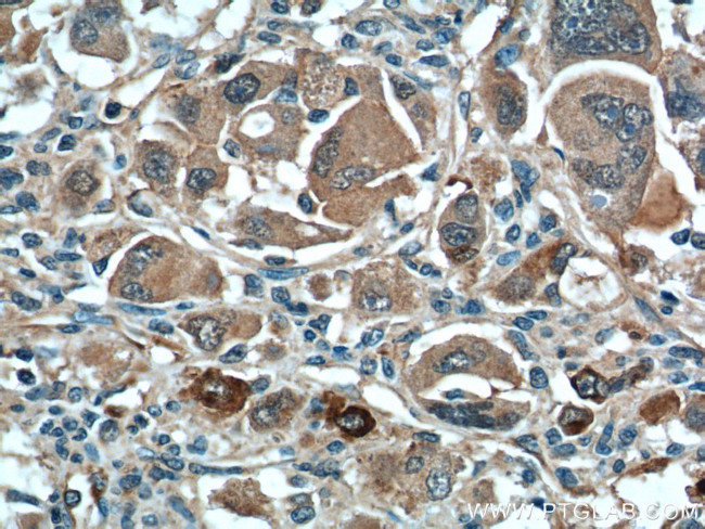 XBP1 Antibody in Immunohistochemistry (Paraffin) (IHC (P))