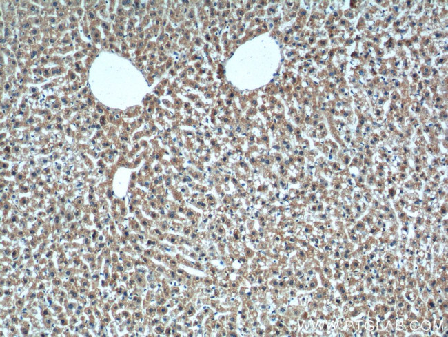 XBP1 Antibody in Immunohistochemistry (Paraffin) (IHC (P))