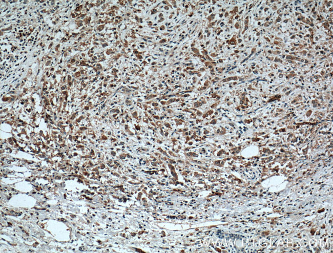 XBP1 Antibody in Immunohistochemistry (Paraffin) (IHC (P))