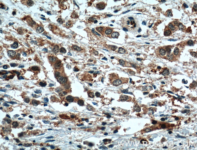 XBP1 Antibody in Immunohistochemistry (Paraffin) (IHC (P))