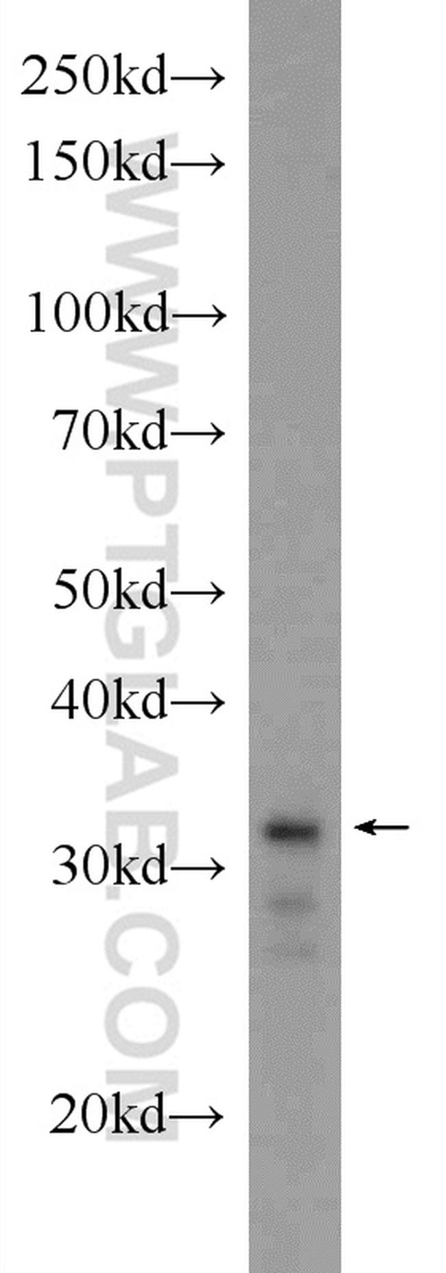 XBP1 Antibody in Western Blot (WB)