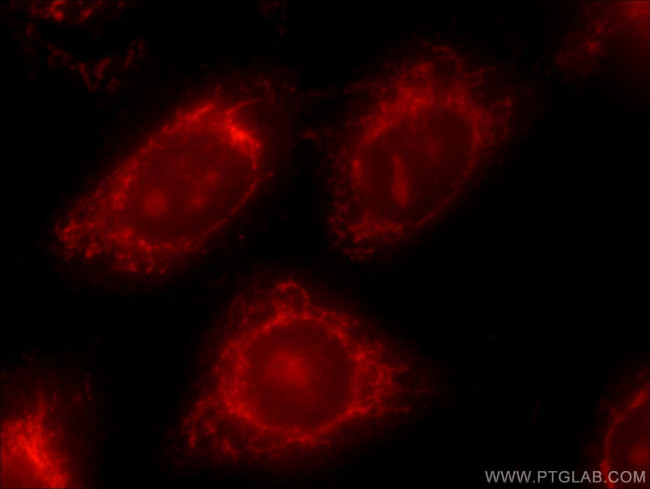 ATF6 Antibody in Immunocytochemistry (ICC/IF)