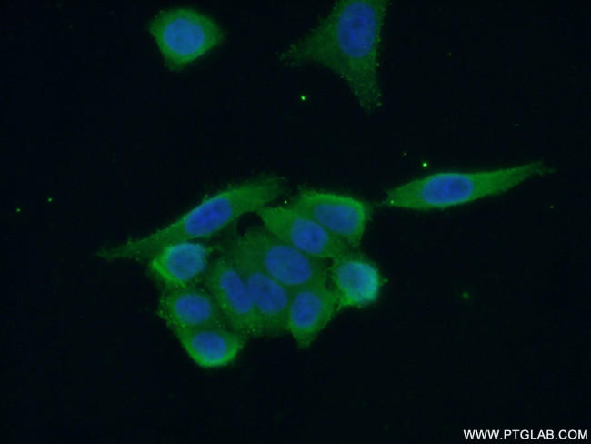 NEK2 Antibody in Immunocytochemistry (ICC/IF)