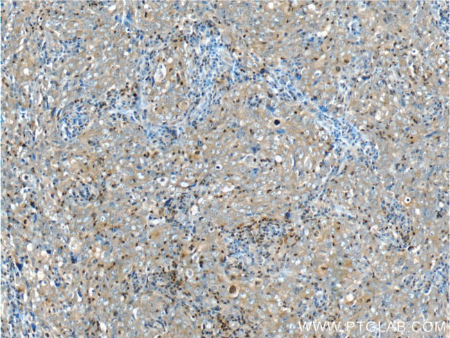 NEK2 Antibody in Immunohistochemistry (Paraffin) (IHC (P))