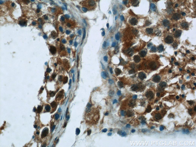 NEK2 Antibody in Immunohistochemistry (Paraffin) (IHC (P))