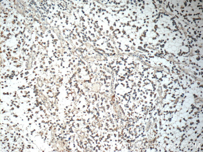 IL-1F6 / IL-36 alpha Antibody in Immunohistochemistry (Paraffin) (IHC (P))