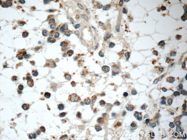 IL-1F6 / IL-36 alpha Antibody in Immunohistochemistry (Paraffin) (IHC (P))