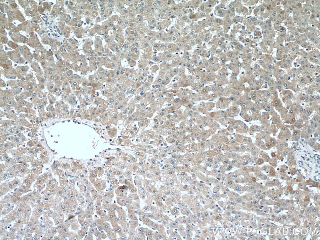 CRP Antibody in Immunohistochemistry (Paraffin) (IHC (P))