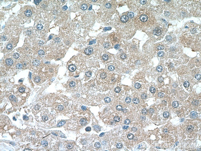 CRP Antibody in Immunohistochemistry (Paraffin) (IHC (P))