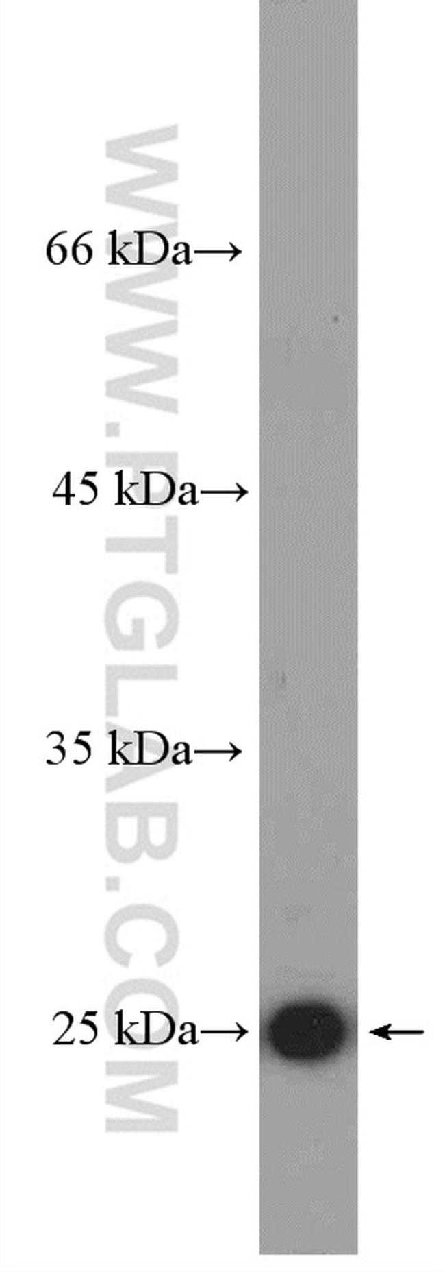 CRP Antibody in Western Blot (WB)