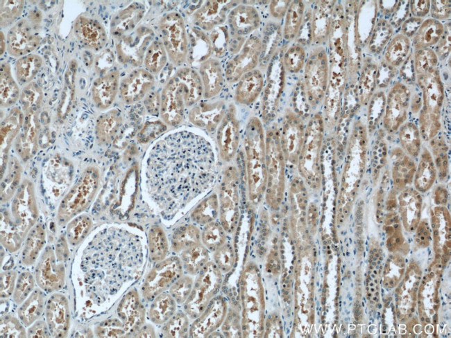 C2orf67 Antibody in Immunohistochemistry (Paraffin) (IHC (P))