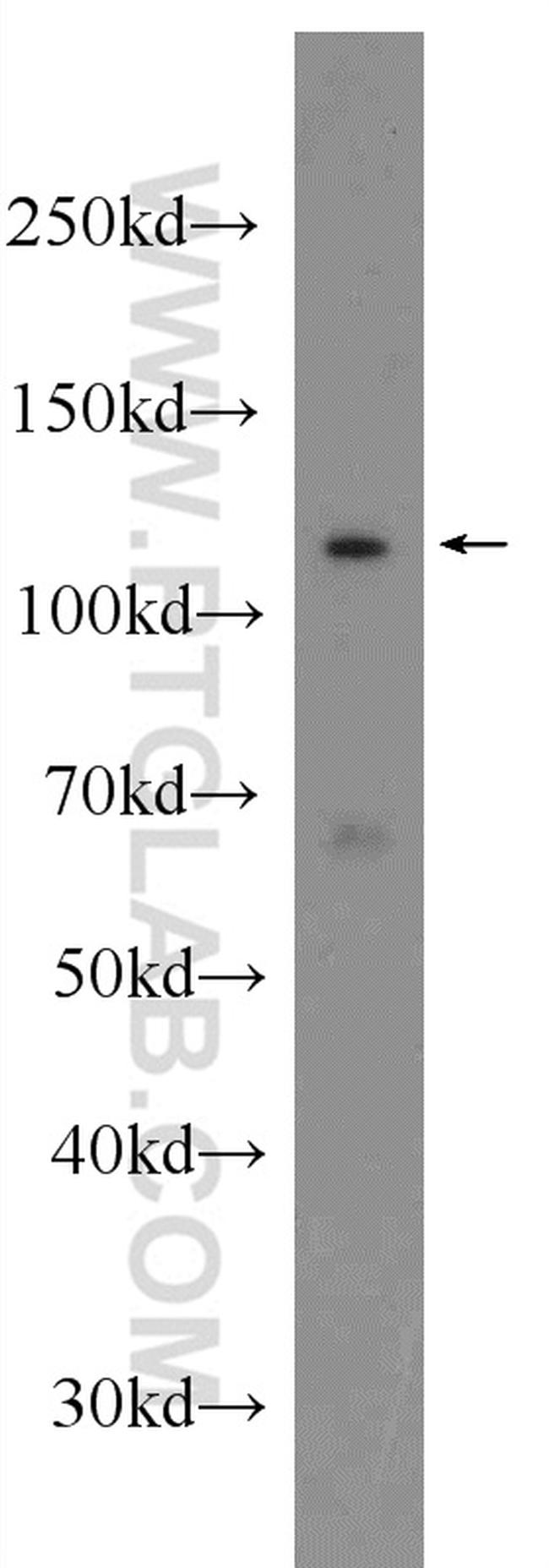 C2orf67 Antibody in Western Blot (WB)