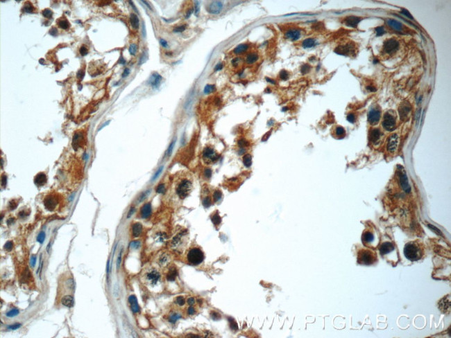 C2orf67 Antibody in Immunohistochemistry (Paraffin) (IHC (P))