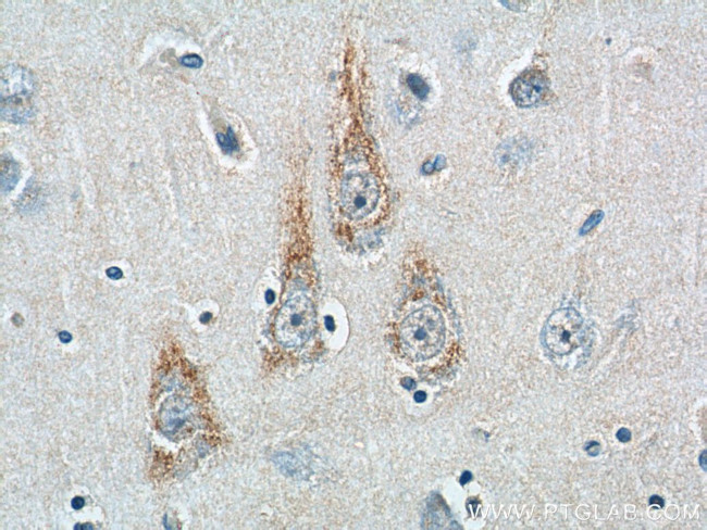 ALK/CD246 Antibody in Immunohistochemistry (Paraffin) (IHC (P))