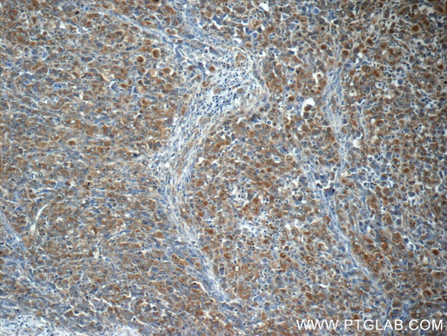 ALK/CD246 Antibody in Immunohistochemistry (Paraffin) (IHC (P))