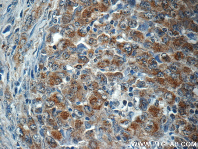 ALK/CD246 Antibody in Immunohistochemistry (Paraffin) (IHC (P))