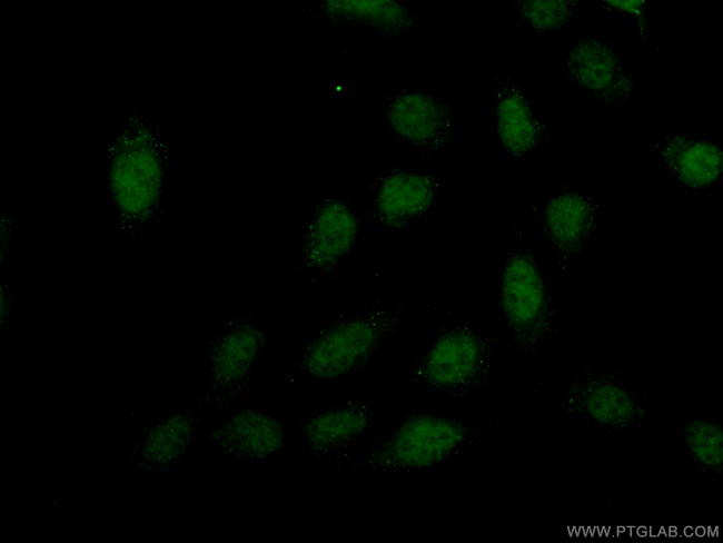 PREX2 Antibody in Immunocytochemistry (ICC/IF)