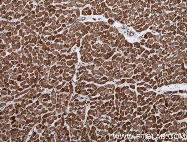 PREX2 Antibody in Immunohistochemistry (Paraffin) (IHC (P))