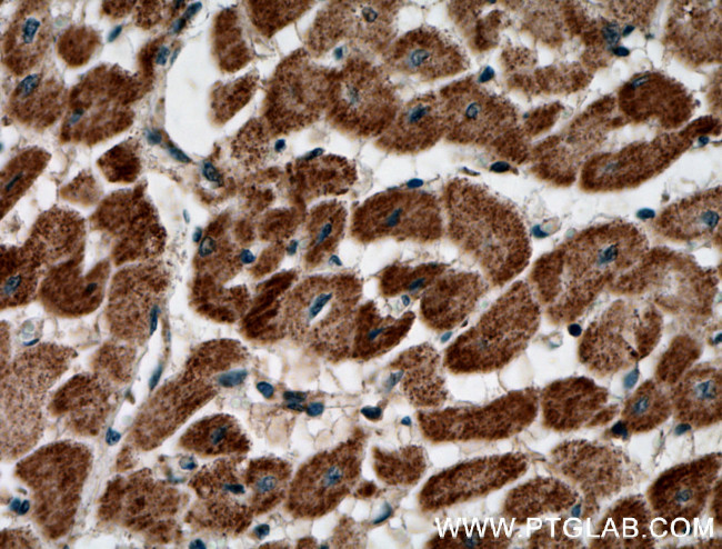 PREX2 Antibody in Immunohistochemistry (Paraffin) (IHC (P))