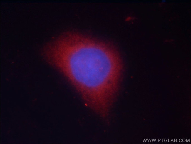 GSK3B Antibody in Immunocytochemistry (ICC/IF)