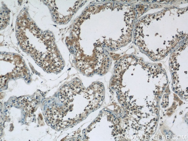 GSK3B Antibody in Immunohistochemistry (Paraffin) (IHC (P))