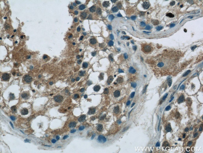 GSK3B Antibody in Immunohistochemistry (Paraffin) (IHC (P))