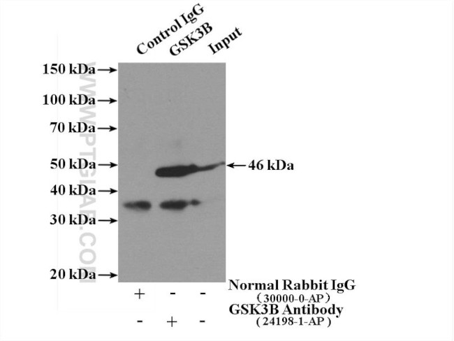 GSK3B Antibody in Immunoprecipitation (IP)