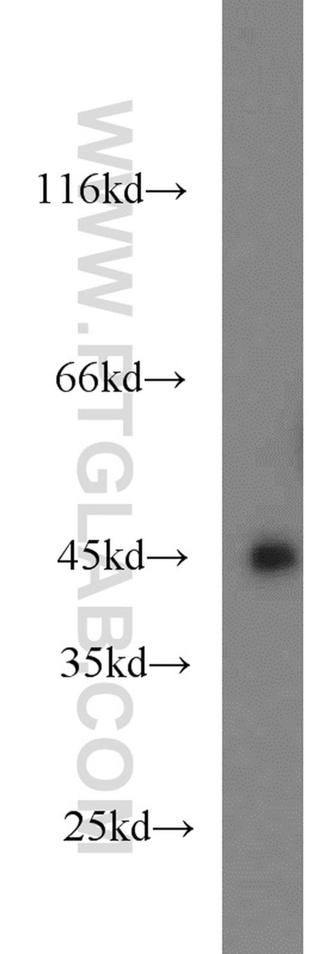 GSK3B Antibody in Western Blot (WB)