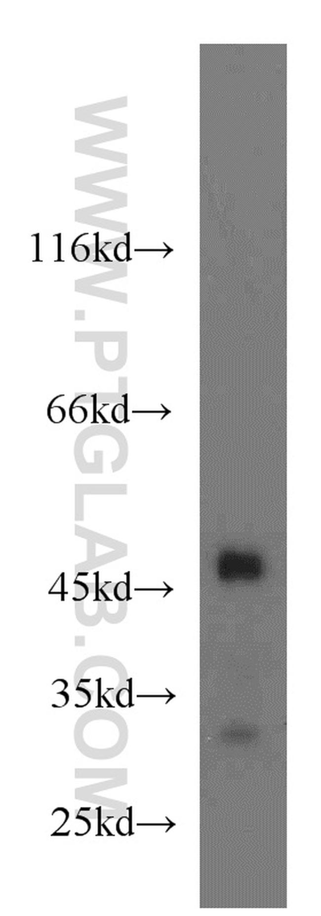 GSK3B Antibody in Western Blot (WB)