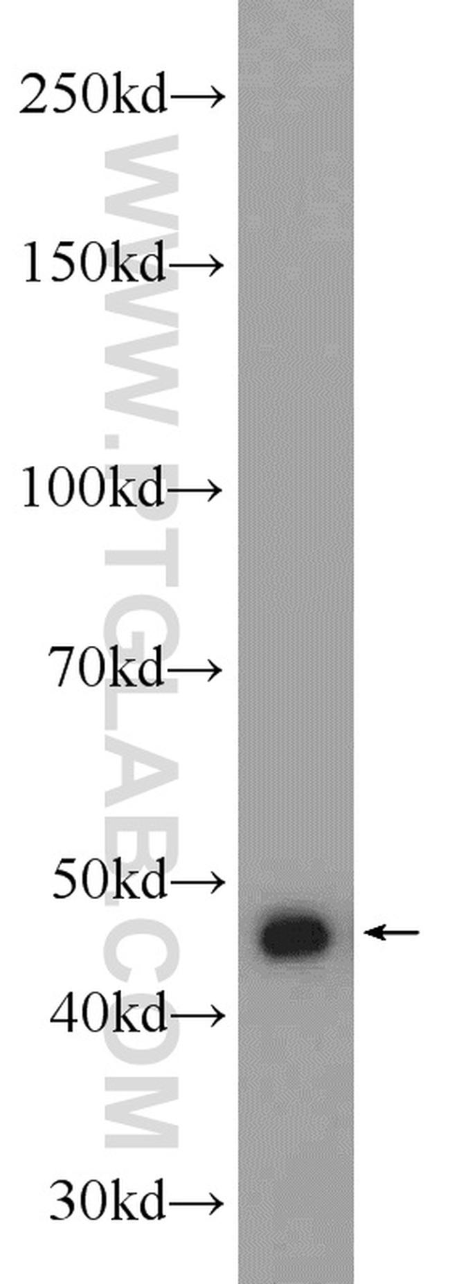 GSK3B Antibody in Western Blot (WB)