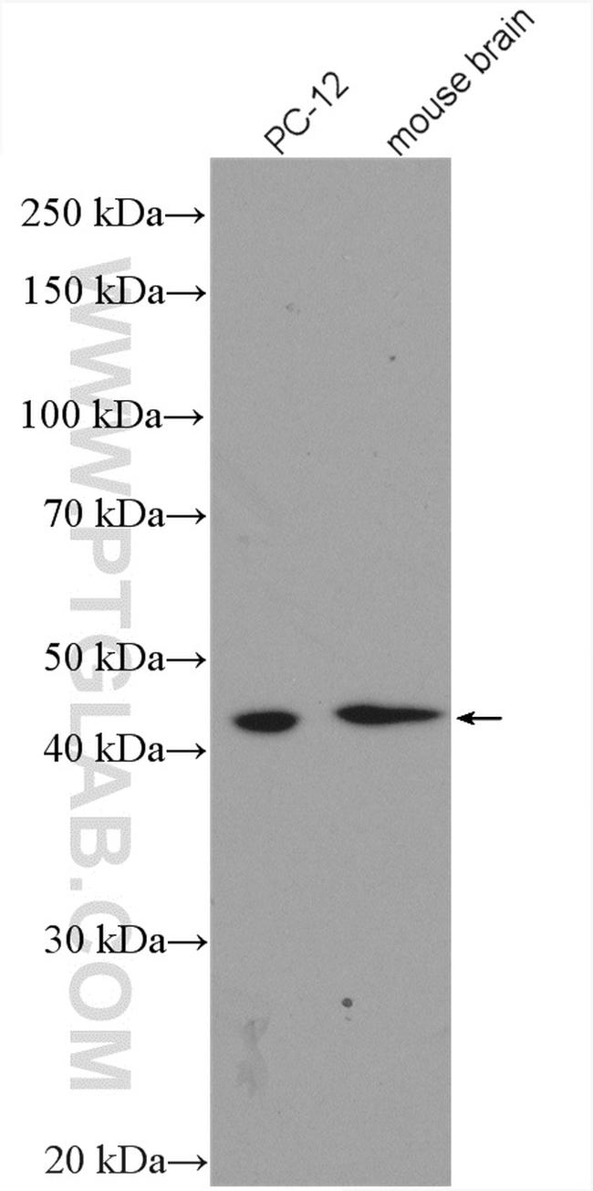 GSK3B Antibody in Western Blot (WB)