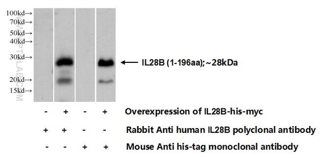 IL28B/ IFNL3 Antibody in Western Blot (WB)