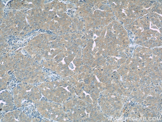 ROMO1 Antibody in Immunohistochemistry (Paraffin) (IHC (P))